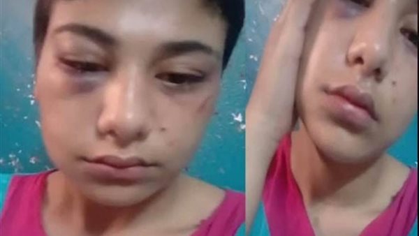 منة عبد العزيز 