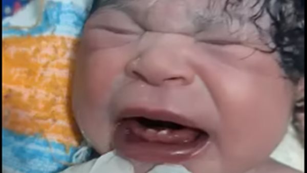 الطفلة المولودة