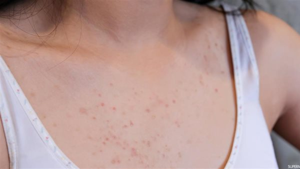 صورة  أرشيفية