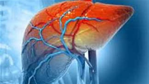 تليف الكبد الدهني