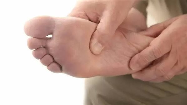 علاج عين السمكة 