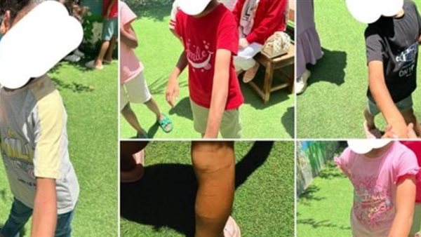 تعذيب أطفال 