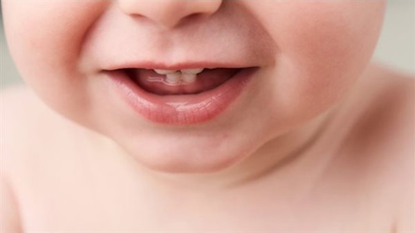 تسنين الأطفال