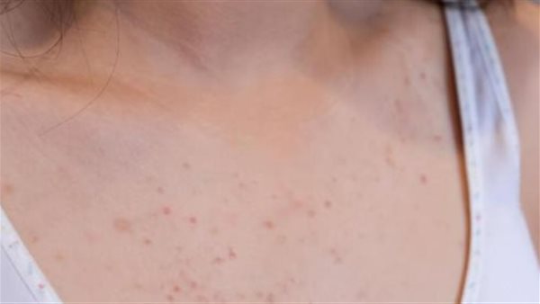 صورة ارشيفية