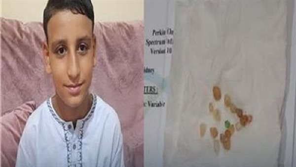 طفل يتبول أحجار كريمة