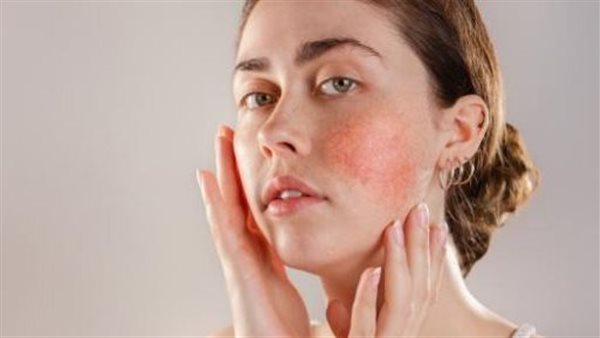 حساسية الجلد 