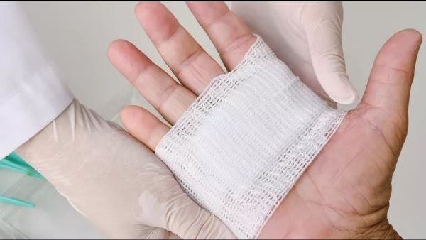 فقاقيع الحروق