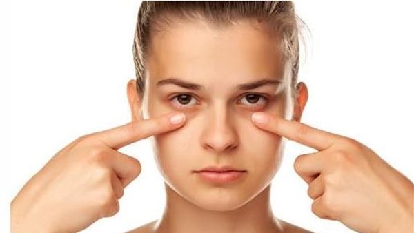 الهالات السوداء 