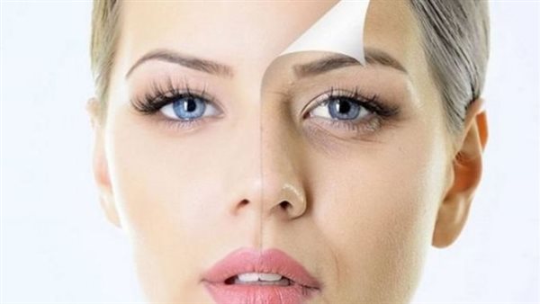 الهالات السوداء 