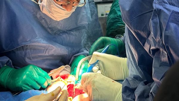 تفاصيل عملية دقيقة