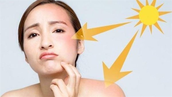 أثار أشعة الشمس 