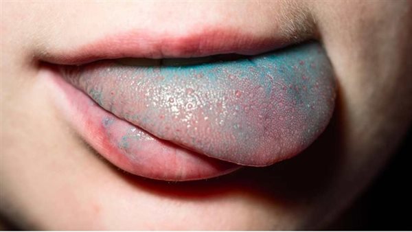 اللسان الأزرق 