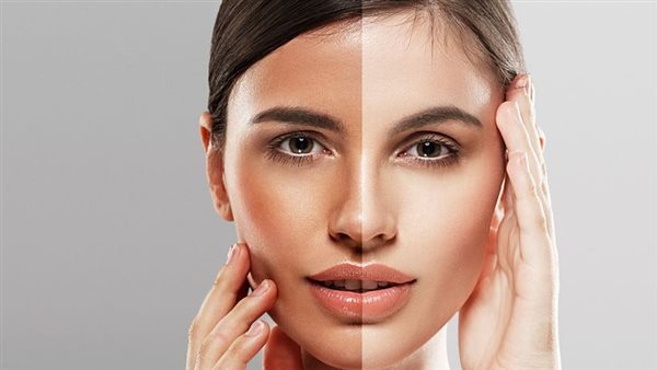 شحوب البشرة الا