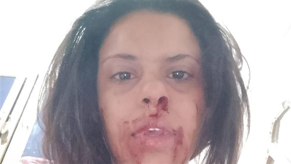 السيدة صاحبة الواقعة