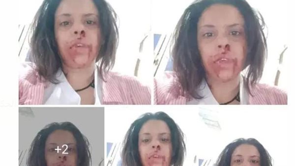 استجابة سريعة من