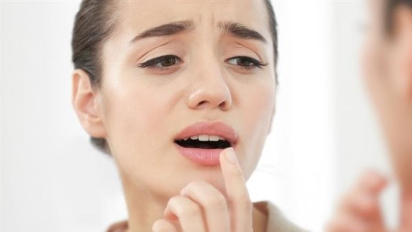 جفاف الشفاه 