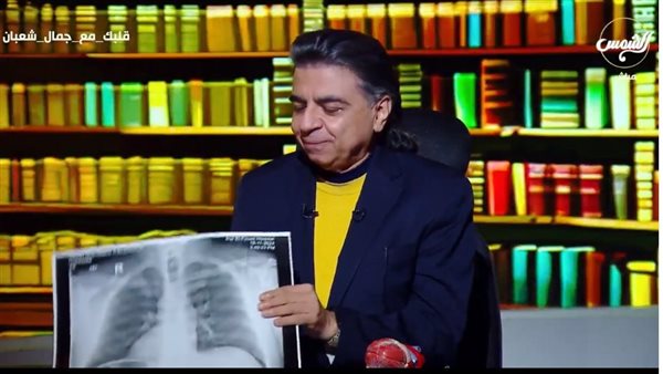 جمال شعباً مستعرضاً