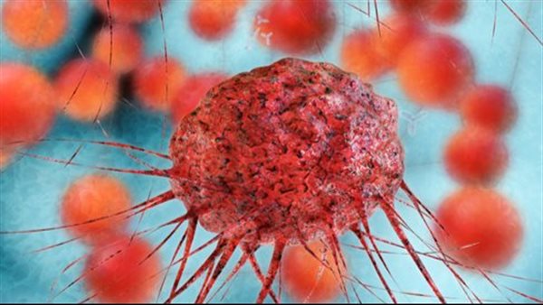 الورم الرحمي 