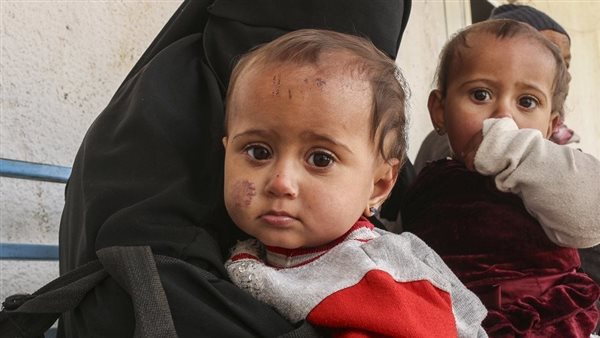  طفلان سوريان