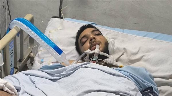 حادث  دهس تريلا مصر