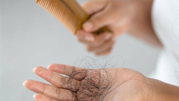 تفسير حلم تساقط الشعر