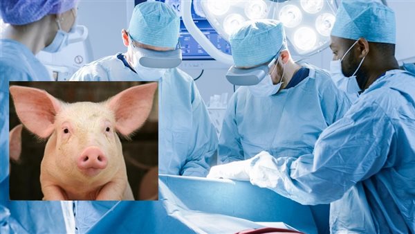 زراعة الأعضاء من