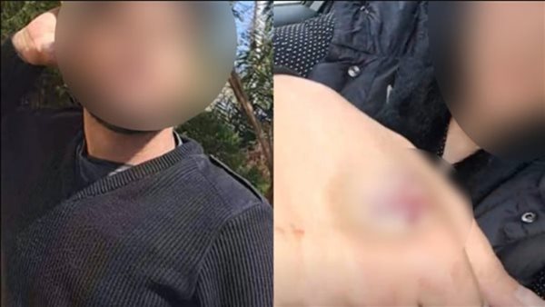 الاعتداء علي طبيبة