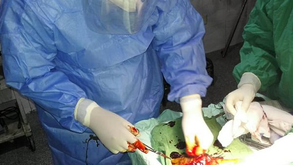 جانب من الجراحة