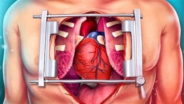 عمليات القلب المفتوح