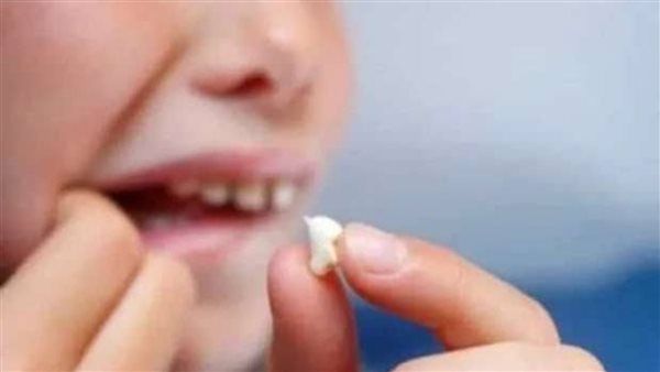 تفسير حلم سقوط الضرس