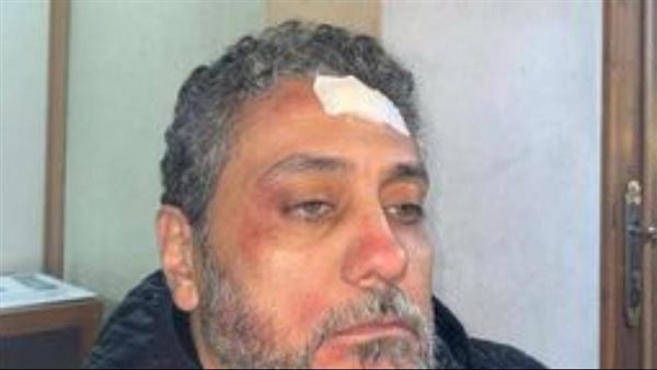 اصابة تامر فرج