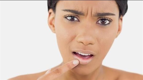 جفاف الشفاه