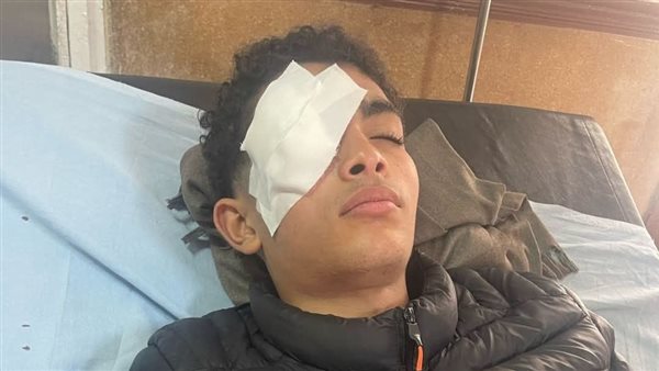 الشب الضاحية 