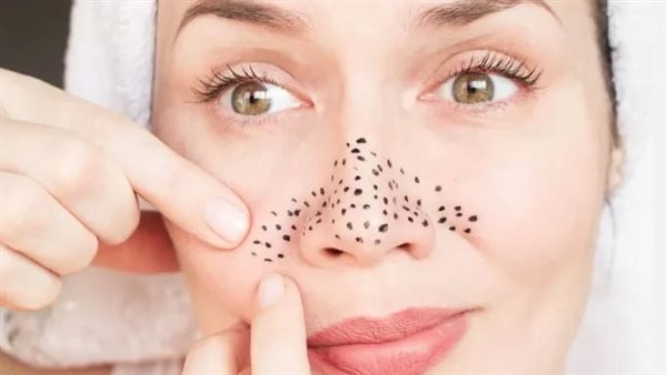 الرؤوس السوداء