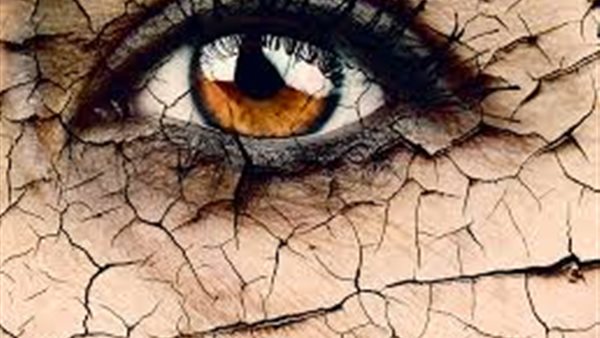 جفاف العين 