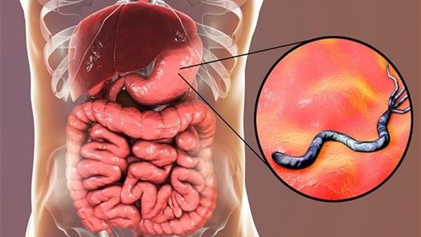 جرثومة المعدة 