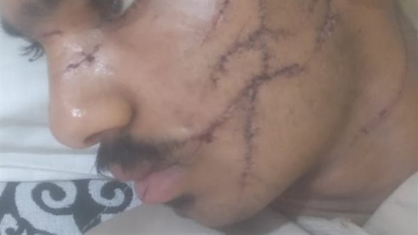 ضحية كفر الشيخ