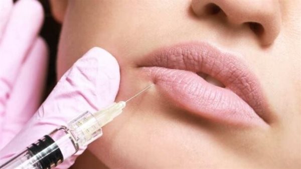 أهم النصائح بعد فيلر