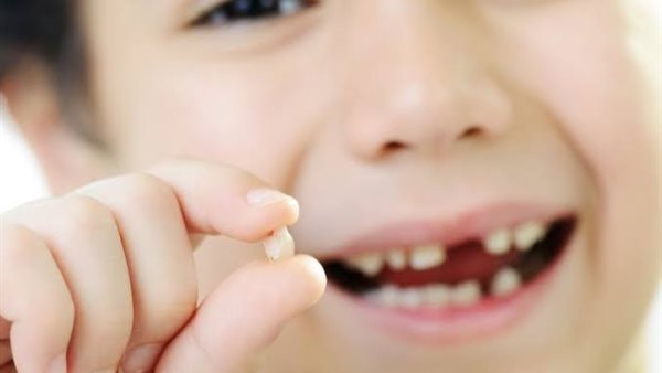 تفسير حلم وقوع الأسنان