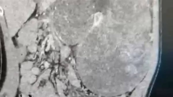 الأشعة الخاصة ب الطفله