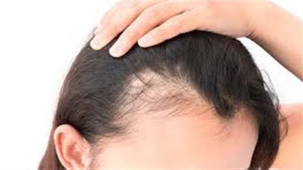 أفضل زيت لإنبات الشعر