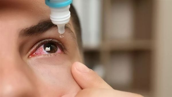 أعراض الرمد الربيعي