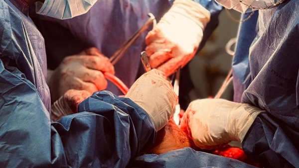 استئصال ورم كبير