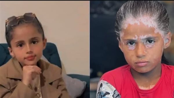 بسبب الفزع والخوف..