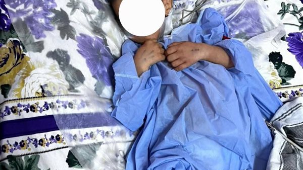 الطفل المصاب فى حادث