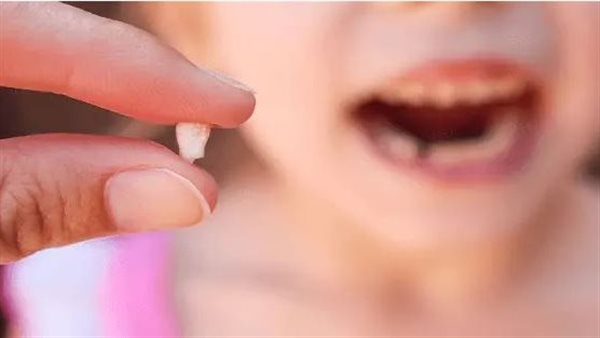 تفسير حلم سقوط الاسنان