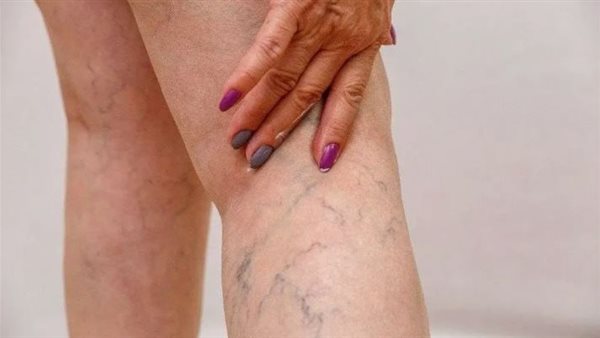 كيف تحمي نفسك من