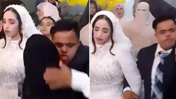 زواج متلازمة داون