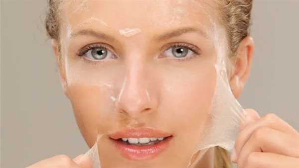  التقشير الكيميائي