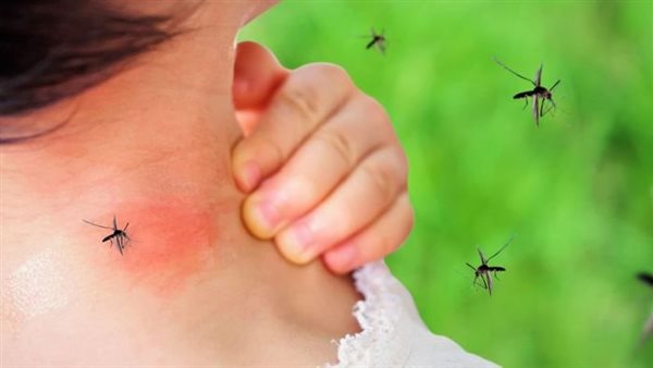  أعراض حمى الضنك